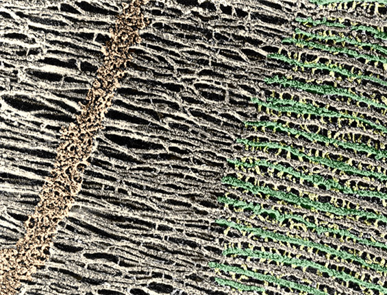 Sarcomere