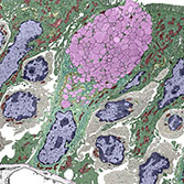 Goblet Cell in the Small Intestine (transmission electron microscopy)